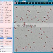 High Accuracy Sperm Counting Computer Assisted Sperm Quality Analyzer Sperm Analyzer Trolley thumbnail-5