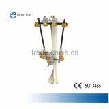 CE Marked Pin External Fixation System for Proximal Humerus