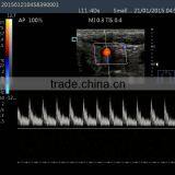 Laptop Color Doppler Ultrasound Syatem With Transducers thumbnail-6