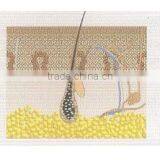 808nm Laser Hair Removal System thumbnail-2