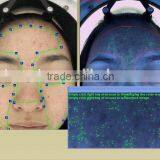 Lowest Price Magic Mirror Skin Analyzer Details Magnifier Skin Testor thumbnail-6