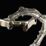 Dental Implant Bar, Implant Overdenture, Implant Prosthesis, Laboratoire Dentaire, Dentallabor, Laboratorio Dental, Dental Laboratory, Shenzhen LJ Dental Lab China thumbnail-2