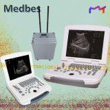 Ultrasound thumbnail-1