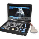 CE Approved Laptop PC Ultrasound Scanner /Ultrasonic Scanner With 3.5Mhz Multi-frequency Convex Probe RUS-9000E2 thumbnail-1