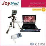 Digital Video Colposcope, Laptop Video Colposcope, Gynecology Video Colposcope thumbnail-1
