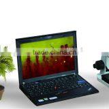 Video Capillary Microcirculation Microscope Capillaroscopy Analyzer