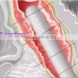 Vaginal Tightening Device Ultrasonic Focusing Technique With Hifu Vagina Treatment thumbnail-4