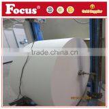 Virgin Wood Fluff Pulp For Baby Diaper and Sanitary Napkin Origin From USA thumbnail-3