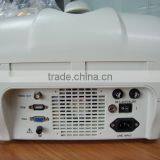 10 Inch Portable Veterinary Ultrasound Scanner for Vet With 3.5MHz Convex Probe RUS-6000V Animal Use thumbnail-2