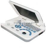 Hot Sale Sony Printer /medical Use Ultrasonic Diagnostic-Large Screen 10.4 Inch Laptop Ultrasound Scanner thumbnail-4