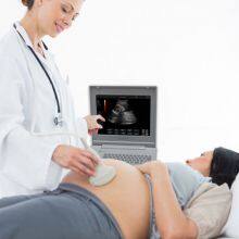 SS-6B Laptop All-Digital Ultrasound thumbnail-5