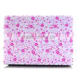 New Ideas 2016 Laptop Case Plastic Protective Sleeve for Macbook thumbnail-1