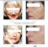 High Quality Photodynamic Therapy thumbnail-5