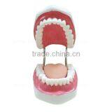 5 Times Human Body Anatomy Teeth Dental Study Model thumbnail-2