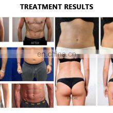 Electric Muscle Stimulation Massager Body Slimming Ems Gym Muscle Stimulation thumbnail-4