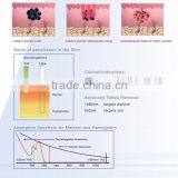 Hori Naevus Removal Latest Vertical Q-Switched Nd Vascular Tumours Treatment YAG Laser Tattoo Removal Nevus Removal Machine thumbnail-4