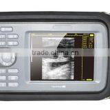 Handheld Ultrasound Scanner HandScan H8 thumbnail-2