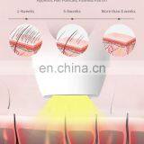 Portable Home Use Ipl Remover Machine Laser Hair Removal Handset thumbnail-3