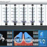 Latest Technology Vacuum Body Slimming Device With Cellulite Reduction and Body Shaping Functions thumbnail-6