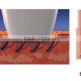 0-150J/cm2 808 Diode Laser Hair Removal Machine 808 Diode Pigmented Hair Laser Hair Removal Permanently 808 Diode Laser Hair Removal thumbnail-6