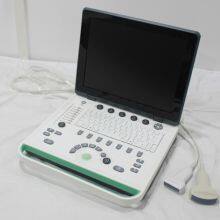 C5Pre Laptop Color Doppler thumbnail-4