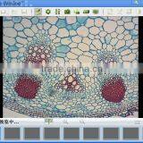 HD High Resolution and High Sensitivity CE Proved Digital Microscope Camera Built-in Relay Lens and Imaging Software thumbnail-3