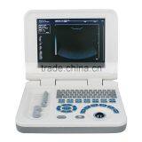 Hot Cheapest Abdominal Pregnant Diagnosis Laptop Ultrasound Scanner/Machine With Probe/Transducer-RUS-9000F2 thumbnail-2