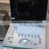 High Quality 3D Color Doppler Ultrasound Machine with internal report