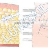 PAL Power Assisted Liposuction Machine thumbnail-3