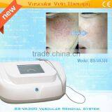 Spider Veins Removal Machine for Red Blood Silk Removal,angeioma Removal thumbnail-3