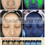 Digital 3d Scanner Facial Microscope Skin Analyzer Check Acne Wrinkles Moisture Scanner thumbnail-3