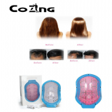 Portable Bald Laser Head Hair Growth Cold Laser Treatment Helmet for Home Remedy thumbnail-2