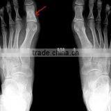 Medical X-ray Film /fuji Printing Clear Image Medical Dry Film With Factory Price thumbnail-2