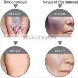 Super Fast Color Touch Screen Logo Customized 10HZ nd Yag Laser Tattoo Removal System thumbnail-6