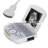 Medical Devices Digital Clear Imaging Portable Ultrasound Machine for Pregnancy thumbnail-2