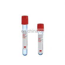 Пластиковая обычная вакуумная пробирка для забора крови PET с красной крышкой, чистая пробирка для больницы