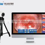 Digital Video Colposcope, Laptop Video Colposcope, Gynecology Video Colposcope thumbnail-1