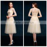 2015 Casual Cocktail Party Designer One Piece Party Dress thumbnail-1