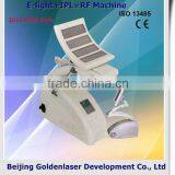 2013 Exporter E-light+IPL+RF Machine Elite Epilation Machine Weight Loss Hair Removal and Facial Skin Rejuvenation thumbnail-1