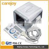 Medical Hospital Ultrasound Diagnostic Machine Portable Ultrasound Equipment thumbnail-1