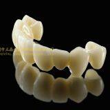 Dental Crown 3M Lava Zirconia, Dental Teeth, Dental Prosthesis, Laboratoire Dentaire, Dentallabor, Laboratorio Dental, Dental Laboratory, Shenzhen LJ Dental Lab China thumbnail-4
