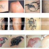 532nm 1064nm Laser Tattoo Removal Nd Laser Machine For Tattoo Removal Yag Laser Tattoo Removal Machine 800mj thumbnail-6