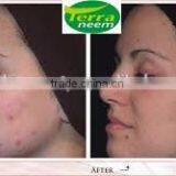 Ayurveda The Great Neem Oil thumbnail-5