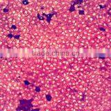 Surface of Simple Squamous Epithelium(silver Staining) Histology Slides