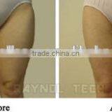 High Frequency  Portable Liposonix 500000 Shot Hips Shaping Times HIFU Body Slimming Machine Pain Free thumbnail-6