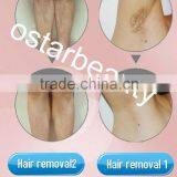 Portable Salon Equipment 808 Laser Hair Removal Beauty Machine DH 04 thumbnail-6