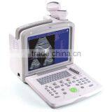 ultrasound scanner (WG-180)