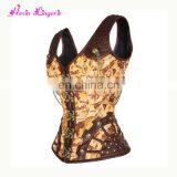 Sexy Yellow Retro Button Steel Boned Shapers Women's Corset thumbnail-2