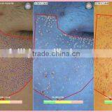 Factory Promotion Facial Skin Moisture Tester Beauty Peronal Care Machine thumbnail-6