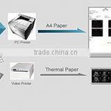 Medical User-friendly 2d Portable Black and White Ultrasound CHISON ECO2 thumbnail-5